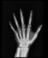 Osobní prstová dozimetrie