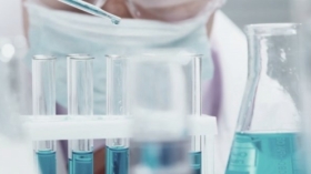 Chemický a mikrobiologický rozbor pitné a kotelní vody