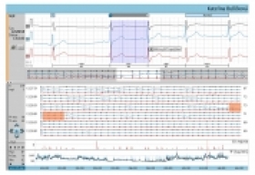 Systém CardioTrack